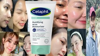 Cetaphil Mattifying Acne Moisturizer  Honest Review [upl. by Sidnee747]