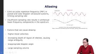 43 Color and Power Doppler ultrasound [upl. by Dewie]