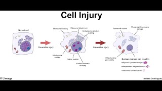 pathogenesis of cell injury [upl. by Alletneuq221]