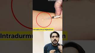 Intradurmul Injection क्या हैं youtubeshorts doctor medical [upl. by Misty]