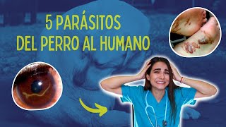 Parásitos que pueden transmitirnos los perros [upl. by Hashim267]