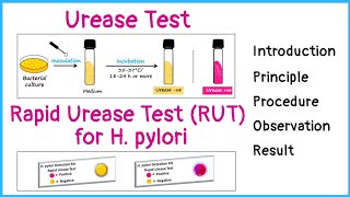 Urease test for identification of bacteria  Rapid urease test for H pylori  Principle  Procedure [upl. by Steffin]