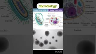 Prokaryotic versus Eukaryotic cells prokaryotic eukaryotic cells [upl. by Ahsakat799]