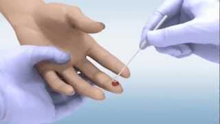 DPP® HIV 12 Assay  Whole Blood Sample [upl. by Alyar572]