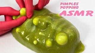 LIVE Relax and Pop Pimples on UltraRealistic Silicone Models [upl. by Rhiana]