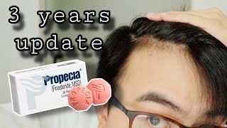 FINASTERIDE 3 years update [upl. by Carmine496]