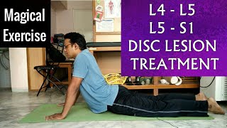 L 4L 5 amp L 5S 1 SLIPPED DISC Treatment  One EXERCISE To Cure LUMBER SLIPPED DISC completely [upl. by Flyn970]