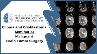 Glioma and Glioblastoma Seminar 4 Malignant Brain Tumor Surgery [upl. by Golightly]