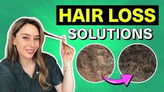 Hair Loss Treatments That Actually Work for Women amp Men  Dr Shereene Idriss [upl. by Yevoc575]