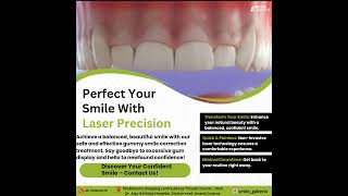 Gummy smile correction by laser [upl. by Lemmie]