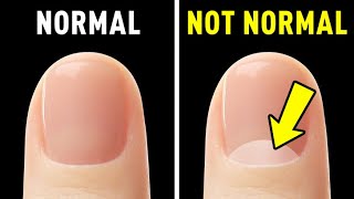 Your Nails Reveal How Rare and Unique Your Body Truly Is [upl. by Ritch590]