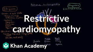 Restrictive cardiomyopathy Pathophysiology and diagnosis  NCLEXRN  Khan Academy [upl. by Dnomayd]