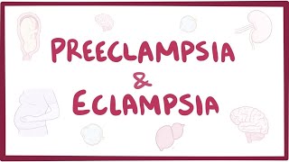 Preeclampsia amp eclampsia  causes symptoms diagnosis treatment pathology [upl. by Tigdirb564]