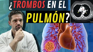 ¡MIRA¡ la Trombosis Coágulos Pulmonar Causas Síntomas y Tratamientos ⚠ [upl. by Paxton]