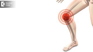 How long does it take to recover from Arthroscopic Knee Surgery  Dr Bala Murali Krishnan [upl. by Ennaeel]