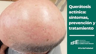 Queratosis actínica qué es prevención diagnóstico y tratamiento  CuidaTuSalud [upl. by Brooke444]