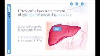 3 Stages of the FibroScan examination [upl. by Anabel920]