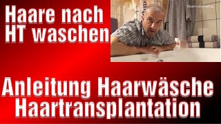 Haare Richtig waschen nach Haartransplantation Krusten entfernen abwaschen Haarwäsche [upl. by Inattirb]