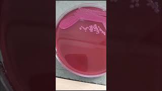 Klebsiella pneumonia grow in macConkey agar for blood cs  Microbiologist  bacterilogh microb mp [upl. by Lorenza]