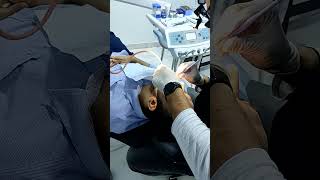 IntraCanal Fluid Aspiration From Large PeriApical Lesion Non Surgical management الكربولة [upl. by Richia890]