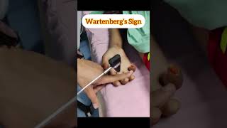 Wartenberg’s Sign  Finger flexion reflex medicalvideos shorts neurology [upl. by West]