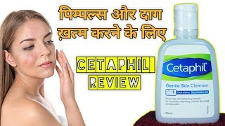 Cetaphil Skin Cleanser  Uses Side Effects amp How to Use in Hindi [upl. by Tingley]