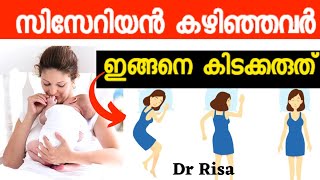 Best Sleep Position After CesareanCare After Delivery [upl. by Ithsav]