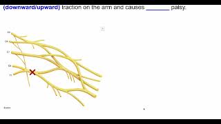 USMLE Step 1 Flashcard Series  Part 5 HighYield Questions flashcards usmle step1 medical [upl. by Aihselat]