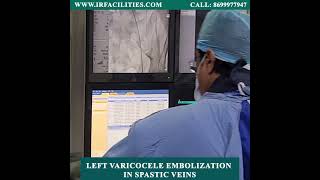 Left Varicocele Embolization in Spastic Veins  IRFACILITIES [upl. by Cristal931]