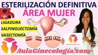 ESTERILIZACIÓN DEFINITVA LIGADURA DE TROMPAS y OTRAS RIESGOS y MÉTODO  Ginecología y Obstetricia [upl. by Eisus]