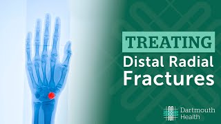 Treating Distal Radius Fractures at Dartmouth Health [upl. by Nerak]