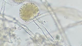 Aspergillus niger [upl. by Allisirp160]