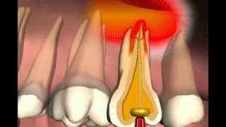 Paranasal Sinuses [upl. by Henigman]