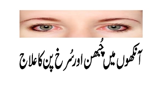 aankhon mein chubhan ka ilaj eye tips in urdu [upl. by Adrianna]