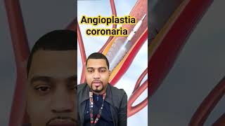 Angioplastia coronaria medicina curiosidades medicine youtubeshorts anatomia youtube doctor [upl. by Eremahs658]