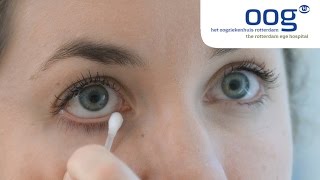 Reinigen en masseren van het ooglid bij blepharitis [upl. by Annaehr]