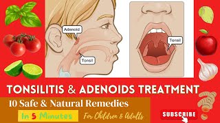 10 Best Effective Proven Home Remedies For Enlarge  Swelling ADENOIDS and TONSILS In Children [upl. by Tully424]