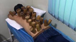 Hijama in Lahore  Cupping Therapy 0317 1172688 [upl. by Tennaj]