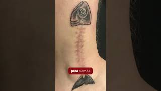 ¿Te hiciste un tatuaje y se formó una cicatriz queloide [upl. by Johannessen158]