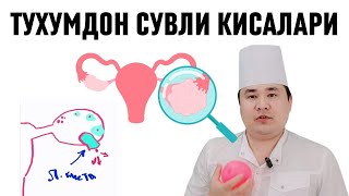 Функционал киста Фолликуляр ва Лютеин кисталари сабалари Асорати ва Даво чоралари хақида Исчанов [upl. by Nehr234]