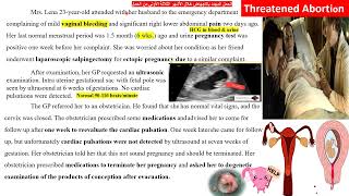 CBL Semester 1 Case of bleeding during pregnancy threatened abortion [upl. by Lettig]