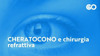 Cheratocono e chirurgia refrattiva [upl. by Bernadene]