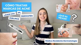 CÓMO TRATAR MARCAS DE ACNÉ EN LA CARA SEPTIEMBRE 2021  LÁSER CO2 PEELINGS DERMAPEN ¿EL MEJOR [upl. by Steiner]