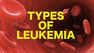 Leukemia  USMLE [upl. by Arykat213]