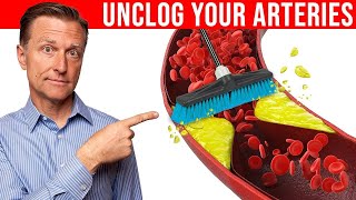 The 1 Best Remedy to Clean Plaque From Your Arteries [upl. by Kcorb]