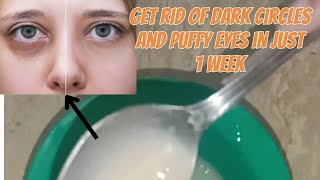 Get rid of puffy eyes amp dark circles in just 1 week shortfeed shorts diy explorepage [upl. by Keare]