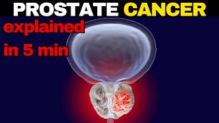 Is Prostate Cancer Deadly  The TRUTH You Need to Know [upl. by Ricki]