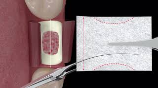 How To Use  RTR amp RTR Membrane [upl. by Jamal]