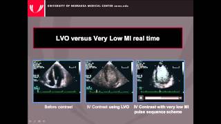 Guidelines for the Cardiac Sonographer in the Performance of Contrast Echocardiography [upl. by Tezile520]