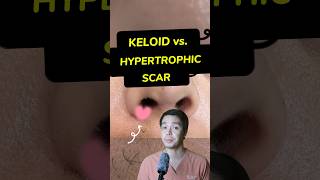 How to avoid KELOID amp HYPERTROPHIC SCAR surgeon surgeonph viral fyp forypupage keloid scar [upl. by Ki822]